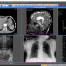 Windows 11 - Sante DICOM Viewer Pro 14.0.13 screenshot